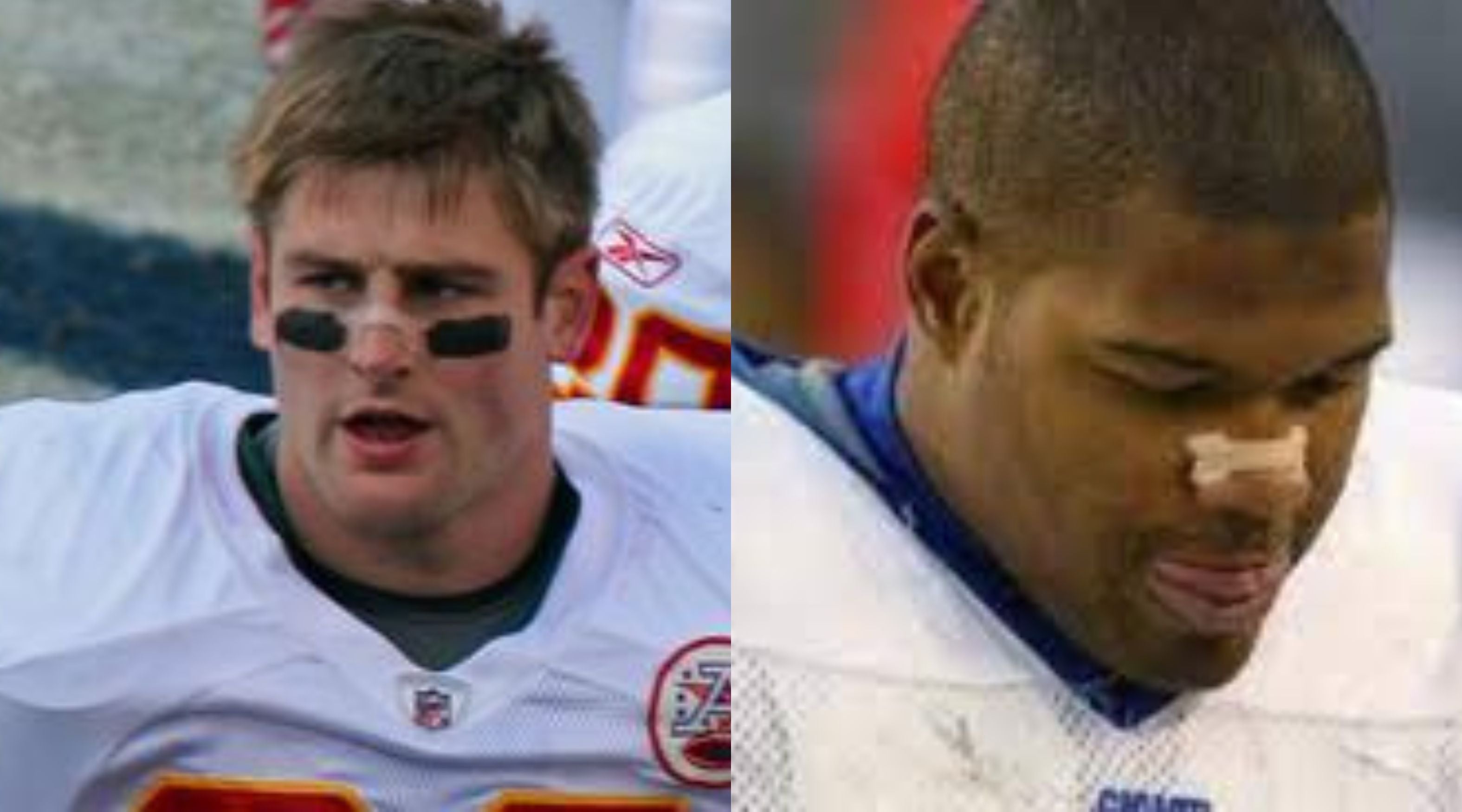 Athletes Embrace Nasal Strips for Improved Performance Nozey