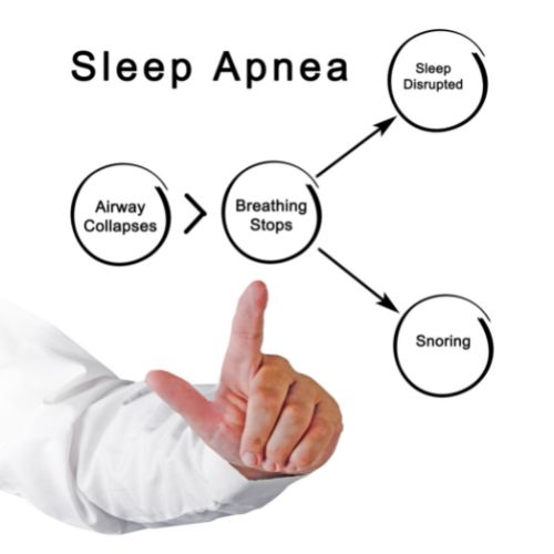 Sleep Apnea: What You Need to Know About Testing and Diagnosis